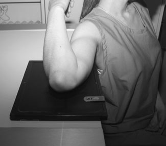 radiografie de Cot evidențiind ulnar groove