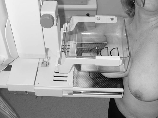• Sân (Mamografie) este ridicat în radiographer’s Mână la form a