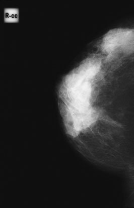 • radiographer stands behind woman și lifts up the