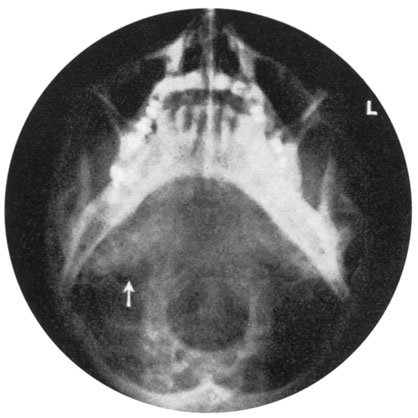 Figura 3: Aspect radiografic / Poziționare (Clark Ed. 12)