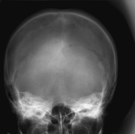Figura 3: Aspect radiografic / Poziționare (Clark Ed. 12)