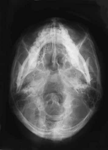 Figura 5: Aspect radiografic / Poziționare (Clark Ed. 12)