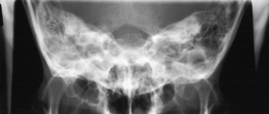 Figura 2: Aspect radiografic / Poziționare (Clark Ed. 12)