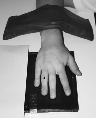 Postero-anterior (PA) radiografie de the