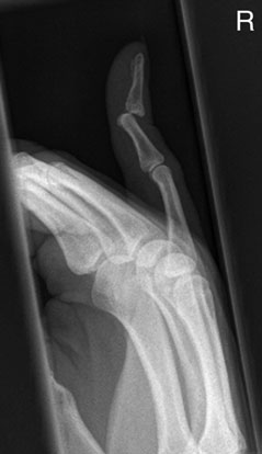 Profil (lateral) radiografie de