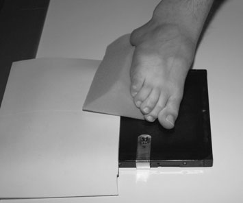 Normal Dorso-Plantară incidență de toate Degete Picior
