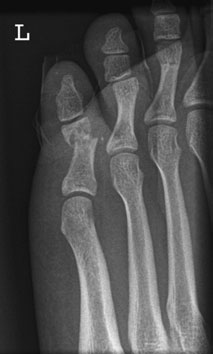 Figura 4: Aspect radiografic / Poziționare (Clark Ed. 12)