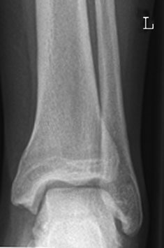 Figura 11: Aspect radiografic / Poziționare (Clark Ed. 12)