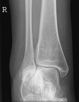 Figura 12: Aspect radiografic / Poziționare (Clark Ed. 12)