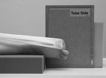 Figura 3: Aspect radiografic / Poziționare (Clark Ed. 12)