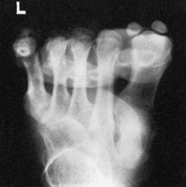Figura 6: Aspect radiografic / Poziționare (Clark Ed. 12)