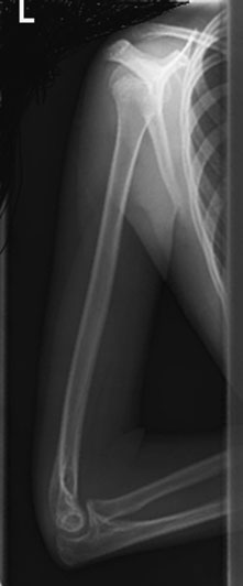 Normal Profil (lateral) radiografie de
