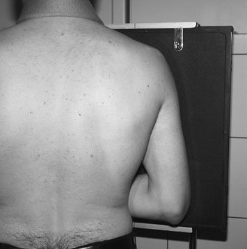 Profil (lateral) radiografie de the