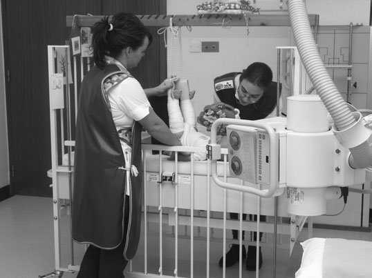 12 Fractură Femur – paediatric