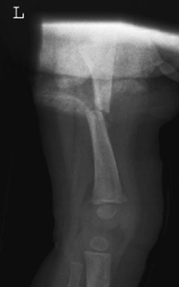 Figura 3: Aspect radiografic / Poziționare (Clark Ed. 12)