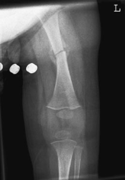 Figura 4: Aspect radiografic / Poziționare (Clark Ed. 12)