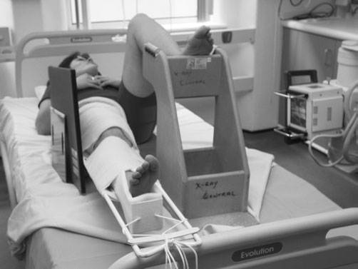 Fascicul Orizontal radiografie.
