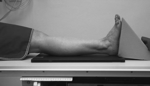 imal end de fibula poate also fie suspiciune de fracturăd when there este a
