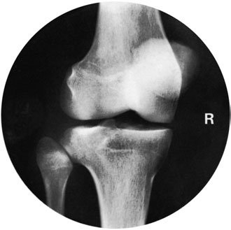 Figura 9: Aspect radiografic / Poziționare (Clark Ed. 12)
