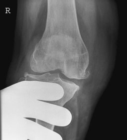 Figura 5: Aspect radiografic / Poziționare (Clark Ed. 12)