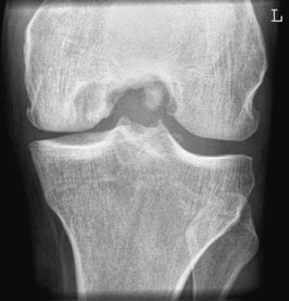Figura 4: Aspect radiografic / Poziționare (Clark Ed. 12)