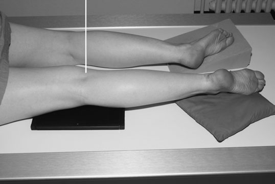 Figura 1: Aspect radiografic / Poziționare (Clark Ed. 12)