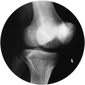 Figura 2: Aspect radiografic / Poziționare (Clark Ed. 12)