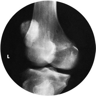 Figura 4: Aspect radiografic / Poziționare (Clark Ed. 12)