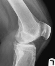 Figura 5: Aspect radiografic / Poziționare (Clark Ed. 12)
