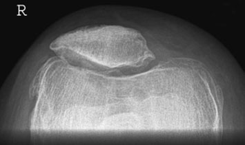 Figura 4: Aspect radiografic / Poziționare (Clark Ed. 12)
