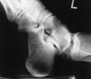 Figura 5: Aspect radiografic / Poziționare (Clark Ed. 12)