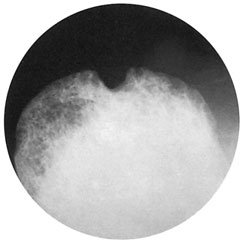 Figura 3: Aspect radiografic / Poziționare (Clark Ed. 12)