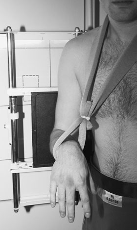 Antero-posterior (AP) radiografie în