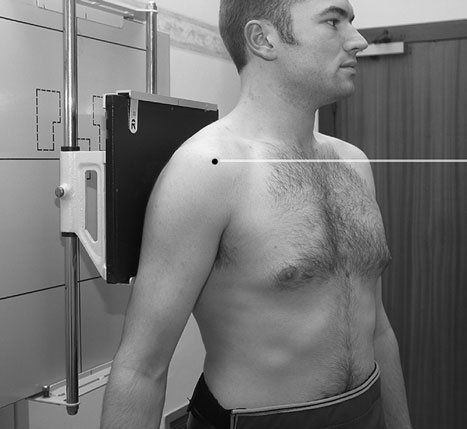 most common reason pentru radiografie de gâtul de the