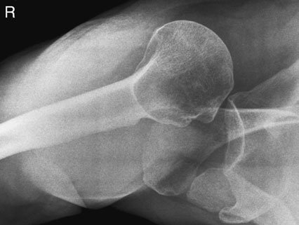 Figura 3: Aspect radiografic / Poziționare (Clark Ed. 12)