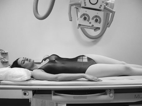 Figura 5: Aspect radiografic / Poziționare (Clark Ed. 12)