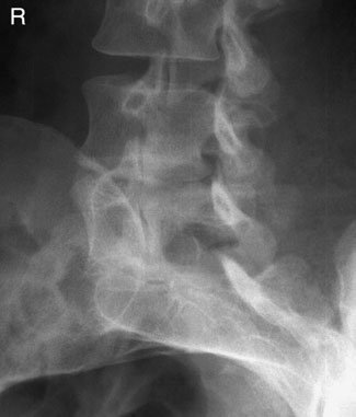 Figura 6: Aspect radiografic / Poziționare (Clark Ed. 12)