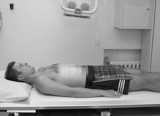 Radiografie antero-posterioară (AP) care evidențiază bilateral coastele inferioare (grilaj costal).