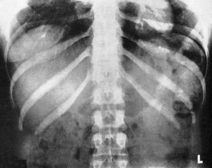 Figura 3: Aspect radiografic / Poziționare (Clark Ed. 12)