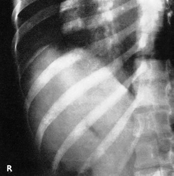 Figura 2: Aspect radiografic / Poziționare (Clark Ed. 12)