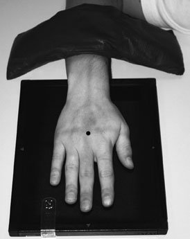 • inter-phalangeal și metacarpo-phalangeal și carpo-