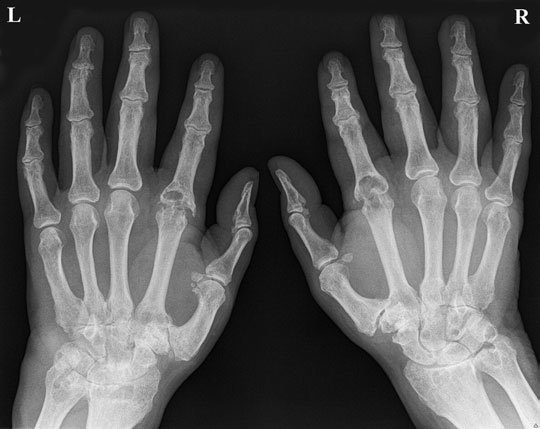 Figura 4: Aspect radiografic / Poziționare (Clark Ed. 12)