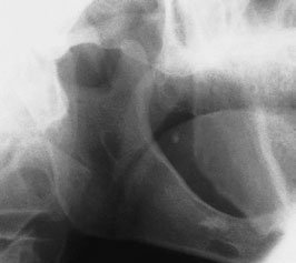 Radiografie oblică de profil a ramurii mandibulei