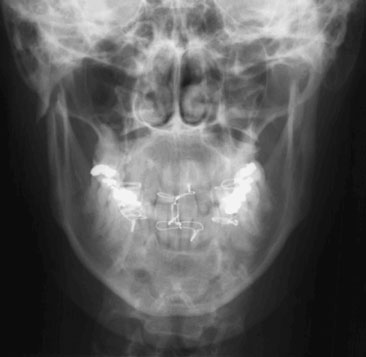Figura 6: Aspect radiografic / Poziționare (Clark Ed. 12)