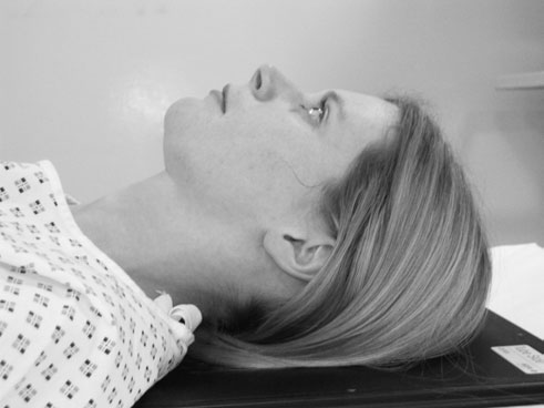 Figura 2: Aspect radiografic / Poziționare (Clark Ed. 12)