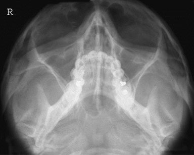 Figura 4: Aspect radiografic / Poziționare (Clark Ed. 12)