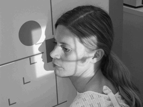 Incidență de profil a masivului facial (oaselor feței), evidențiind un corp străin radiopac