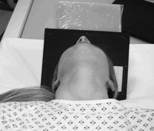 Radiografia are un rol important în asigurarea faptului că o eventuală