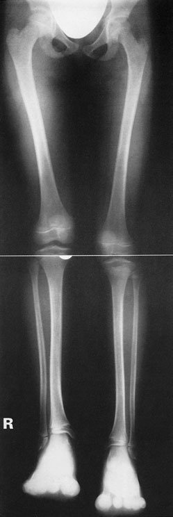 Figura 2: Aspect radiografic / Poziționare (Clark Ed. 12)