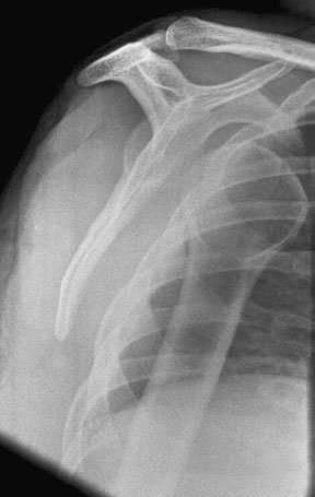 Figura 6: Aspect radiografic / Poziționare (Clark Ed. 12)